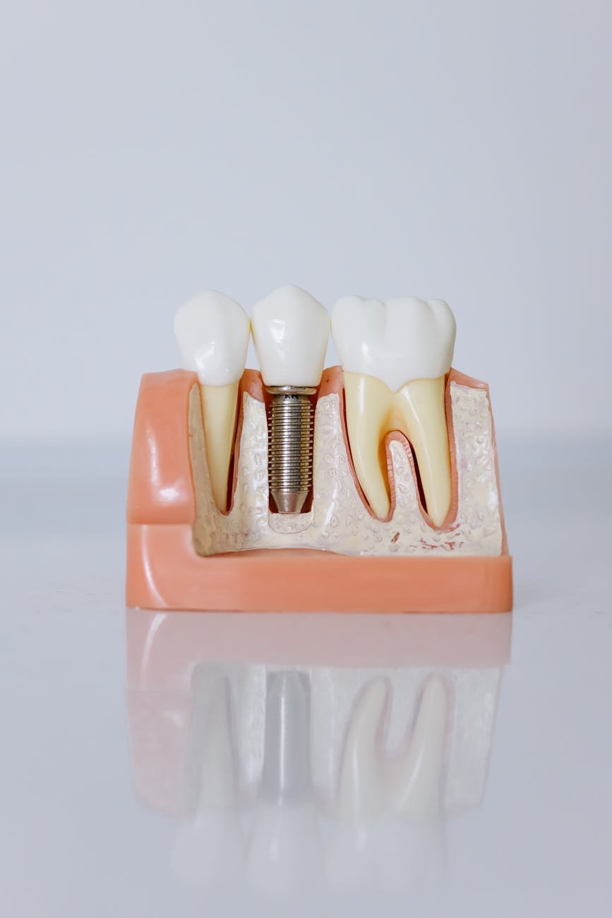 close up shot of dental implant model